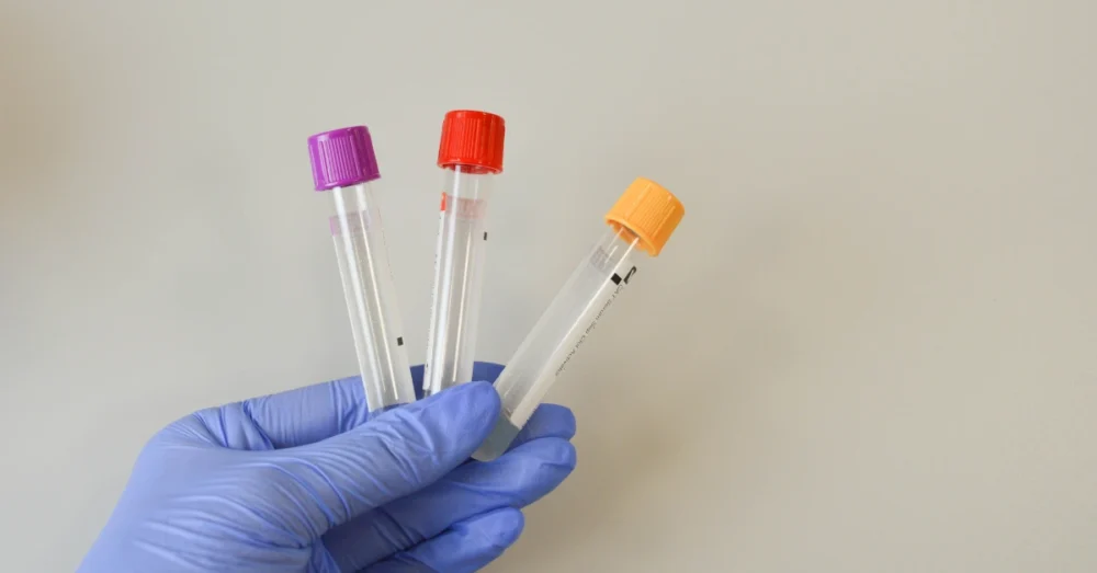 Gloved hand holding three blood sample tubes with colored caps used for functional medicine testing.